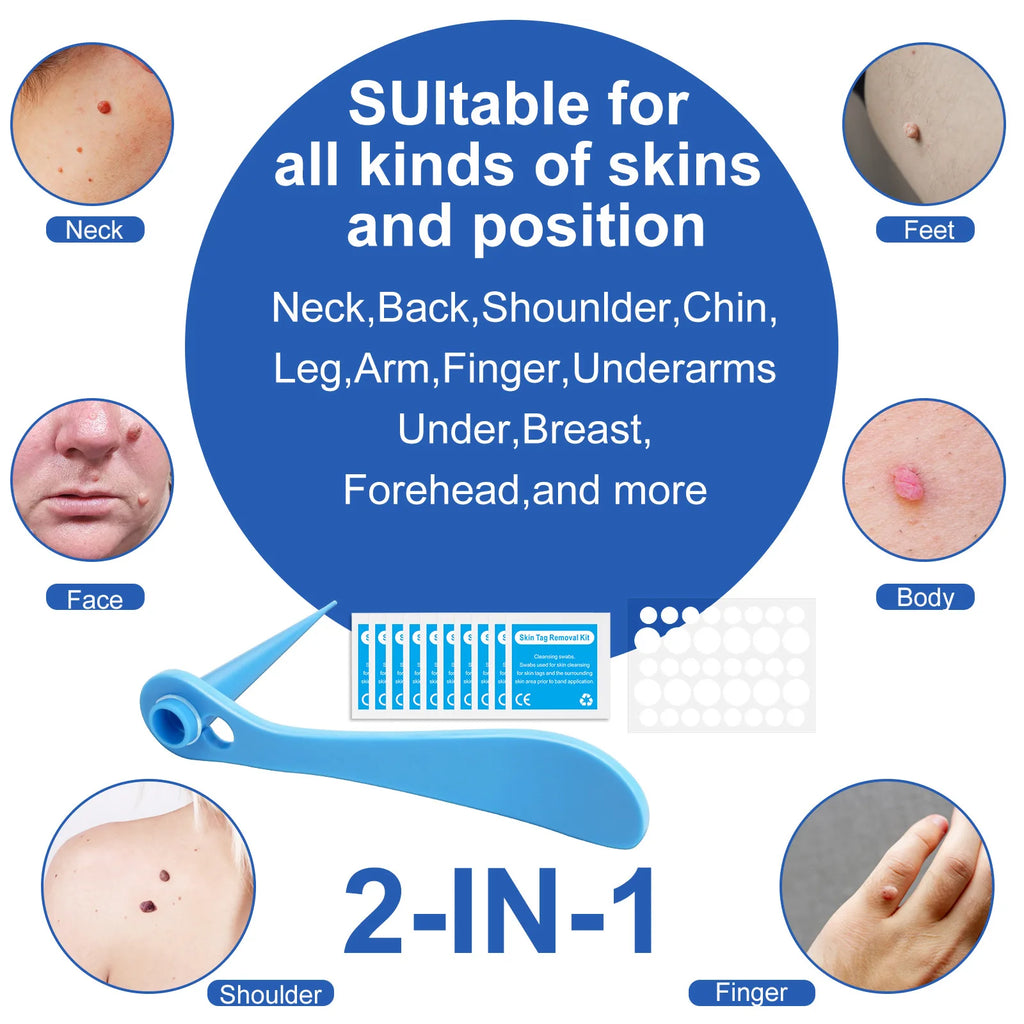 2 In 1 Auto Skin Tag Removal Kit Painless Mole Wart Remover Equipment Micro 2-9mm Treatment Tool Easy To Clean Skin Care Tool